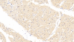 Invitrogen FABP4 Monoclonal Antibody (C12), Invitrogen 20 &mu;L; Unconjugated:Antibodies,