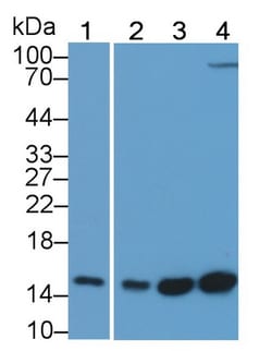Invitrogen FABP4 Monoclonal Antibody (C12), Invitrogen 20 &mu;L; Unconjugated:Antibodies,