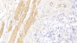 Invitrogen alpha-Cardiac Actin Monoclonal Antibody (C302), Invitrogen:Antibodies:Primary