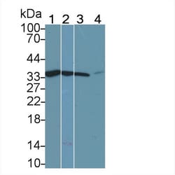 Invitrogen Calponin 2 Monoclonal Antibody (C8), Invitrogen:Antibodies:Primary