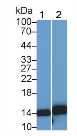 Invitrogen S100A9 Monoclonal Antibody (H5), Invitrogen 20 &mu;L; Unconjugated:Antibodies,