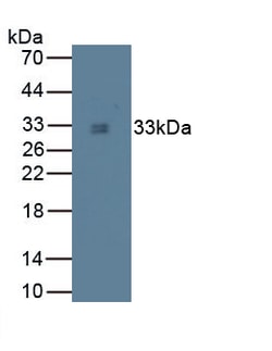Tryptase Monoclonal Antibody (C13), Invitrogen:Antibodies:Primary Antibodies