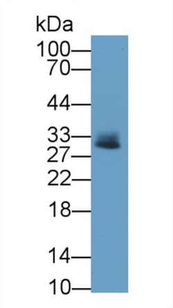 Tryptase Monoclonal Antibody (C13), Invitrogen:Antibodies:Primary Antibodies