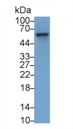 Invitrogen Factor IX Monoclonal Antibody (C2), Invitrogen 20 &mu;L; Unconjugated:Antibodies,
