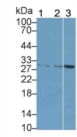 CTLA-4 Monoclonal Antibody (D13), Invitrogen:Antibodies:Primary Antibodies