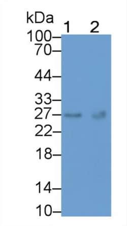 Invitrogen TK1 Monoclonal Antibody (C301), Invitrogen 20 &mu;L; Unconjugated:Antibodies,