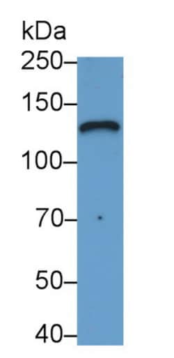 Invitrogen Laminin gamma-2 Monoclonal Antibody (D1), Invitrogen 200 &mu;L;