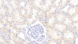 Invitrogen alpha-1 Antitrypsin Monoclonal Antibody (H8), Invitrogen 20