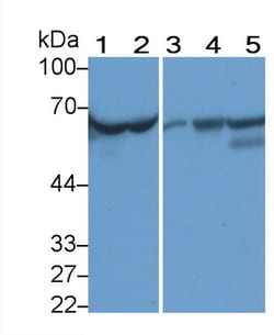 Invitrogen alpha-1 Antitrypsin Monoclonal Antibody (H8), Invitrogen 20