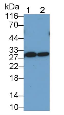 Invitrogen TIGIT Monoclonal Antibody (D3), Invitrogen 200 &mu;L; Unconjugated:Antibodies,