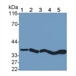 Invitrogen Cathepsin B Monoclonal Antibody (D5), Invitrogen 200 &mu;L;