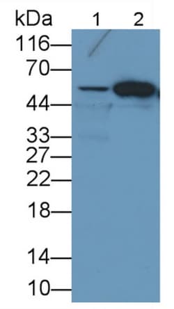 Invitrogen FOXP1 Monoclonal Antibody (D6), Invitrogen 20 &mu;L; Unconjugated:Antibodies,
