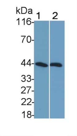 Invitrogen SHBG Monoclonal Antibody (H3), Invitrogen 200 &mu;L; Unconjugated:Antibodies,