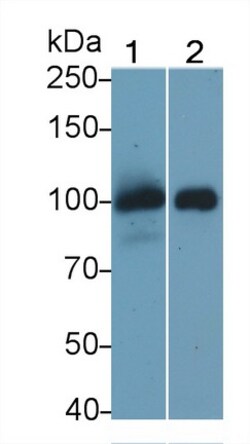 Invitrogen Thrombomodulin Monoclonal Antibody (H2), Invitrogen:Antibodies:Primary