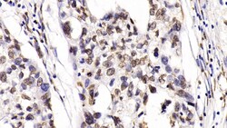Invitrogen HDAC1 Monoclonal Antibody (E31), Invitrogen 20 &mu;L; Unconjugated:Antibodies,