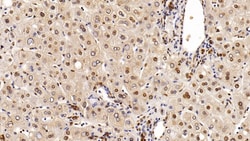 Invitrogen HDAC1 Monoclonal Antibody (E31), Invitrogen 20 &mu;L; Unconjugated:Antibodies,