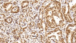 Invitrogen HDAC1 Monoclonal Antibody (E31), Invitrogen 20 &mu;L; Unconjugated:Antibodies,