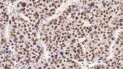 Invitrogen HDAC1 Monoclonal Antibody (E31), Invitrogen 20 &mu;L; Unconjugated:Antibodies,