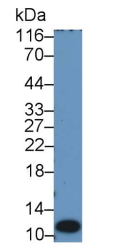 S100A12 Monoclonal Antibody (C7), Invitrogen:Antibodies:Primary Antibodies