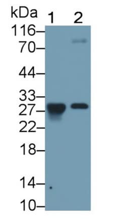Granzyme K Monoclonal Antibody (C8), Invitrogen:Antibodies:Primary Antibodies