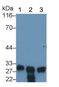 MPZ Monoclonal Antibody (C13), Invitrogen:Antibodies:Primary Antibodies