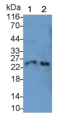 Invitrogen Cathepsin S Monoclonal Antibody (C1), Invitrogen:Anticuerpos:Anticuerpos