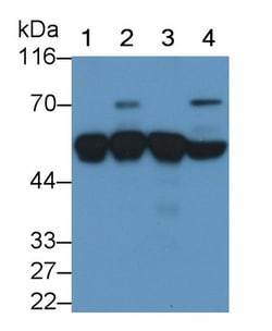 Invitrogen alpha-1 Antitrypsin Monoclonal Antibody (C5), Invitrogen 20