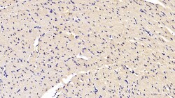 SOD1 Monoclonal Antibody (C1), Invitrogen:Antibodies:Primary Antibodies