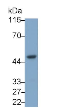 Invitrogen CXCR2 Monoclonal Antibody (C8), Invitrogen 20 &mu;L; Unconjugated:Antibodies,