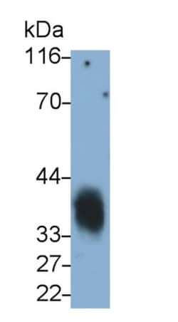 Invitrogen CD7 Monoclonal Antibody (D5), Invitrogen:Antibodies:Primary