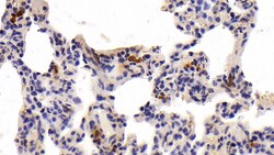 Tryptase Monoclonal Antibody (C2), Invitrogen:Antibodies:Primary Antibodies