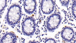 Tryptase Monoclonal Antibody (C2), Invitrogen:Antibodies:Primary Antibodies