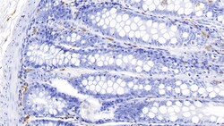 Tryptase Monoclonal Antibody (C2), Invitrogen:Antibodies:Primary Antibodies