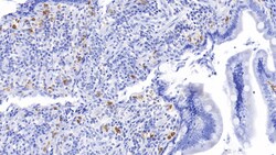 Tryptase Monoclonal Antibody (C2), Invitrogen:Antibodies:Primary Antibodies