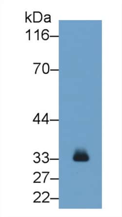Tryptase Monoclonal Antibody (C2), Invitrogen:Antibodies:Primary Antibodies