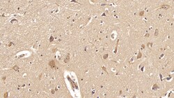 Invitrogen ACVR2A Monoclonal Antibody (C1), Invitrogen 20 &mu;L; Unconjugated:Antibodies,