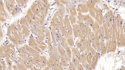 Invitrogen ACVR2A Monoclonal Antibody (C1), Invitrogen 20 &mu;L; Unconjugated:Antibodies,
