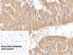 Invitrogen ACVR2A Monoclonal Antibody (C1), Invitrogen 20 &mu;L; Unconjugated:Antibodies,