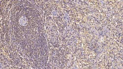 Invitrogen ACVR2A Monoclonal Antibody (C1), Invitrogen 20 &mu;L; Unconjugated:Antibodies,
