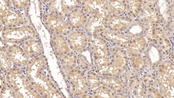 Invitrogen ACVR2A Monoclonal Antibody (C1), Invitrogen 20 &mu;L; Unconjugated:Antibodies,