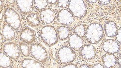 Invitrogen IL-17A Monoclonal Antibody (D1), Invitrogen 200 &mu;L; Unconjugated:Antibodies,