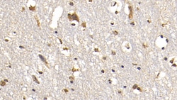 FAP Monoclonal Antibody (D3), Invitrogen:Antibodies:Primary Antibodies