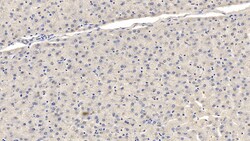 FAP Monoclonal Antibody (D3), Invitrogen:Antibodies:Primary Antibodies
