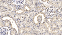 FAP Monoclonal Antibody (D3), Invitrogen:Antibodies:Primary Antibodies