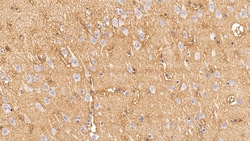 Invitrogen Aquaporin 4 Monoclonal Antibody (C1), Invitrogen 20 &mu;L; Unconjugated:Antibodies,