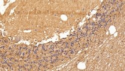 Invitrogen Aquaporin 4 Monoclonal Antibody (C1), Invitrogen 20 &mu;L; Unconjugated:Antibodies,