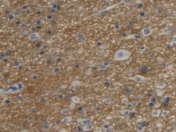 Invitrogen Aquaporin 4 Monoclonal Antibody (C1), Invitrogen 20 &mu;L; Unconjugated:Antibodies,