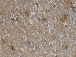 Invitrogen Aquaporin 4 Monoclonal Antibody (C1), Invitrogen 20 &mu;L; Unconjugated:Antibodies,