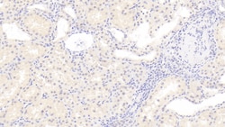 RHD Monoclonal Antibody (C1), Invitrogen:Antibodies:Primary Antibodies
