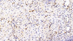 CCL3 Monoclonal Antibody (C6), Invitrogen:Antibodies:Primary Antibodies